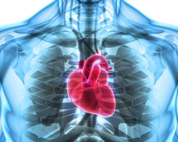 Primary PCI for heart attack management